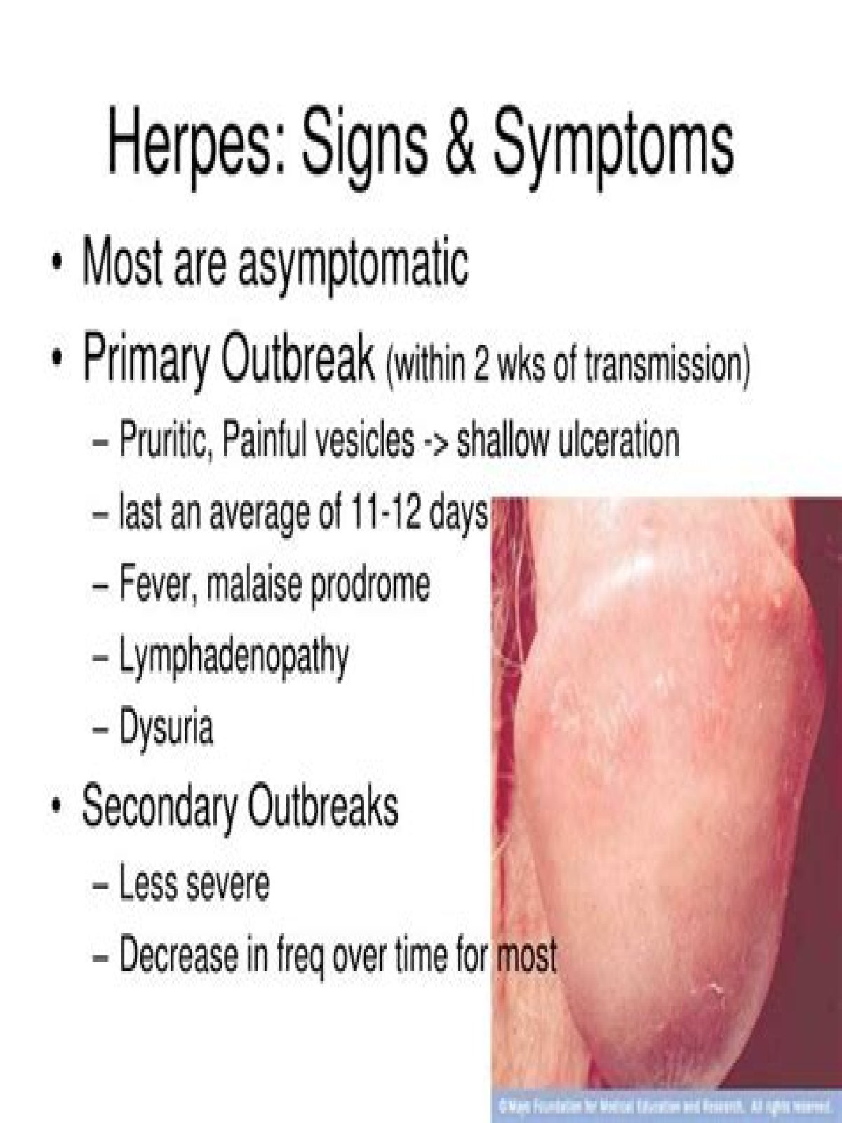 Is Herpes Contagious all the time?