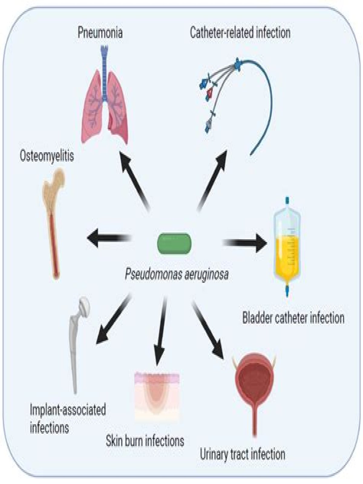 What does Pseudomonas aeruginosa cause in humans?