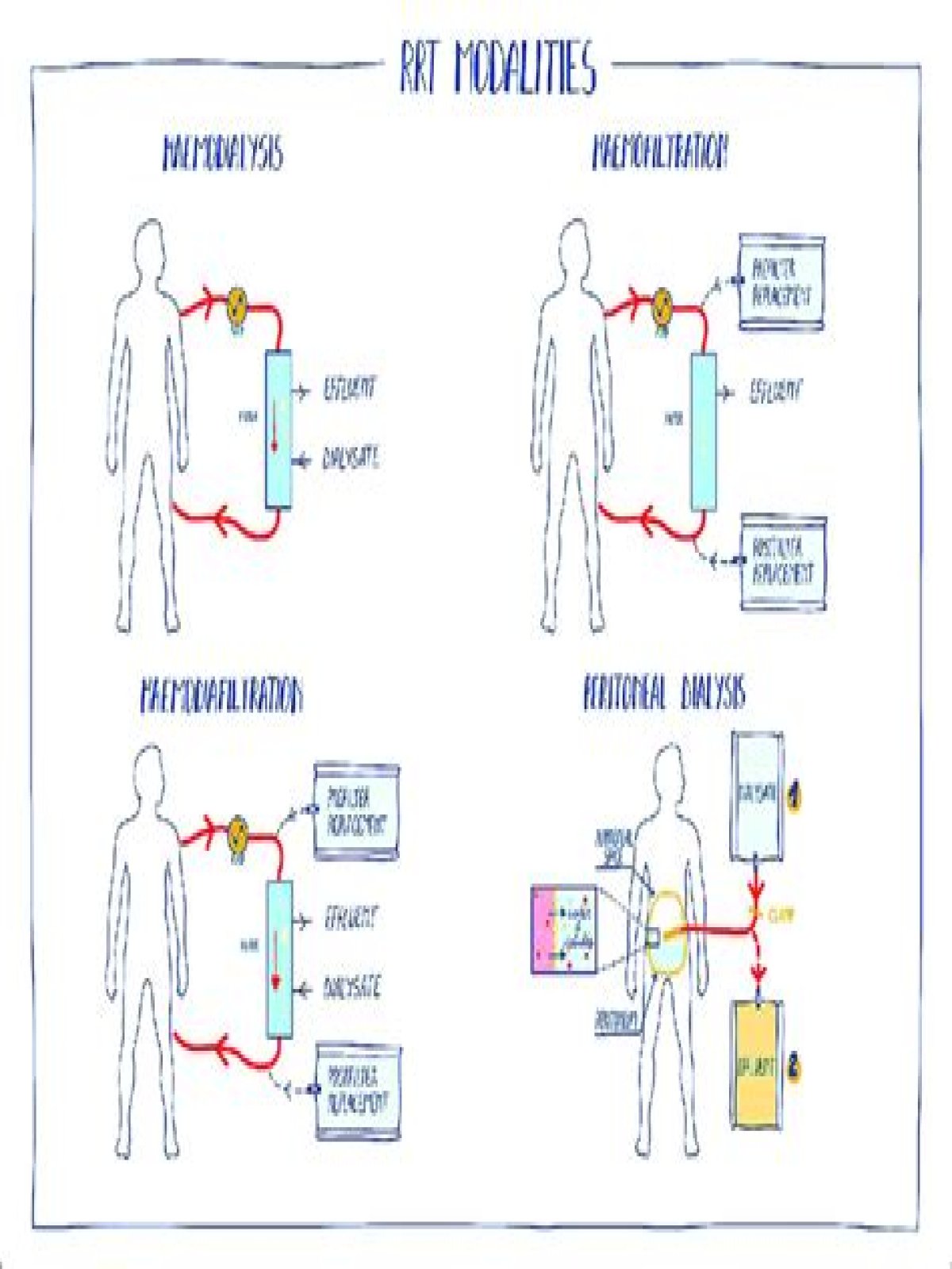 What does RRT2 stand for on my W2?