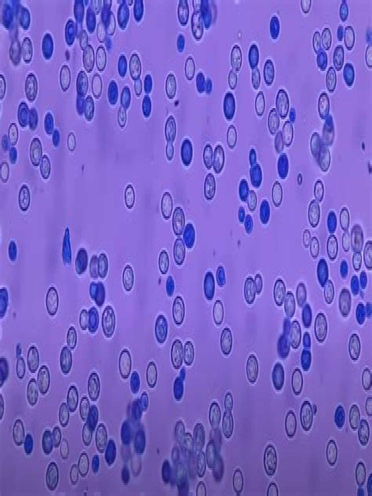 Why does methylene blue stain dead yeast cells?
